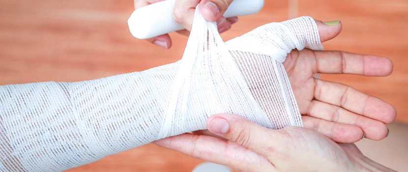 Montana Burn Injury Lawyer