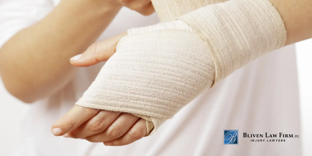 Montana Burn Injury Lawyer